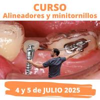 Formación: Curso Alineadores y minitornillos 4 y 5 de Julio 2025